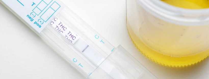 Can You Fail a Drug Test for Using CBD or Topicals That Have THC?